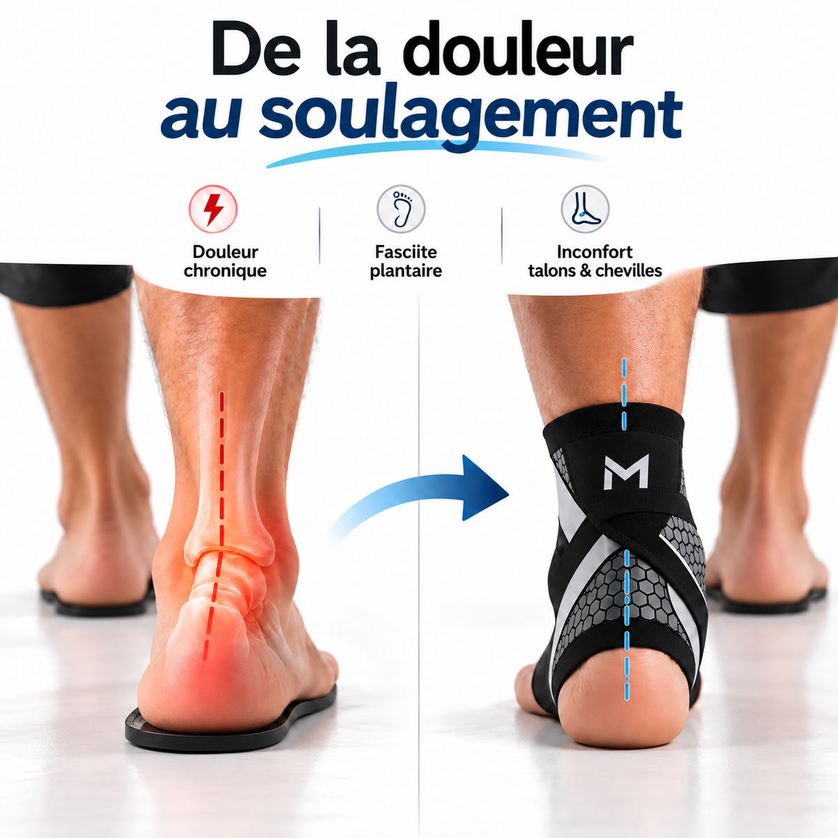 Miko Stabil – Chevillère de Compression & Soutien du Talon